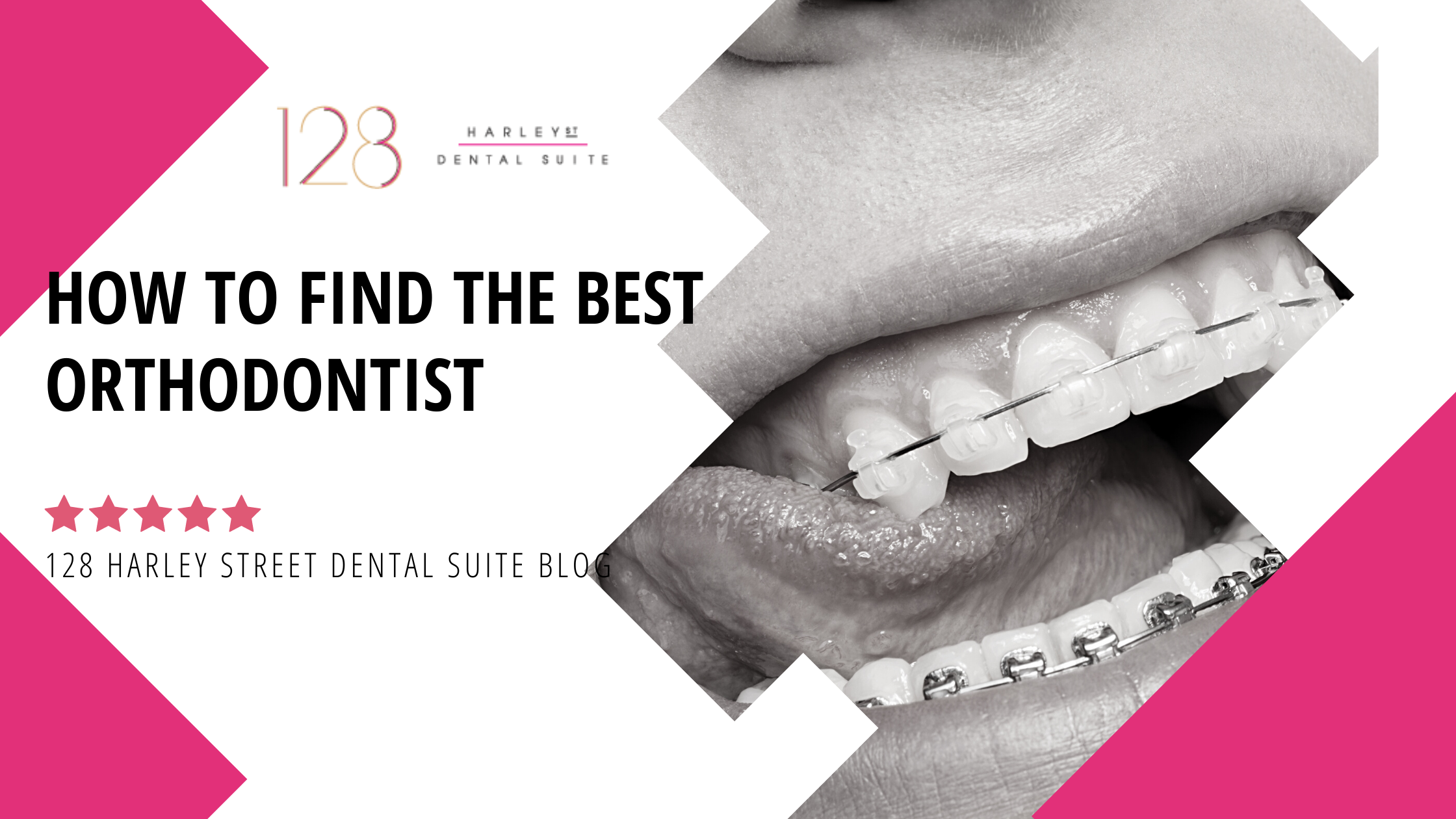 How to Find the Best Orthodontist