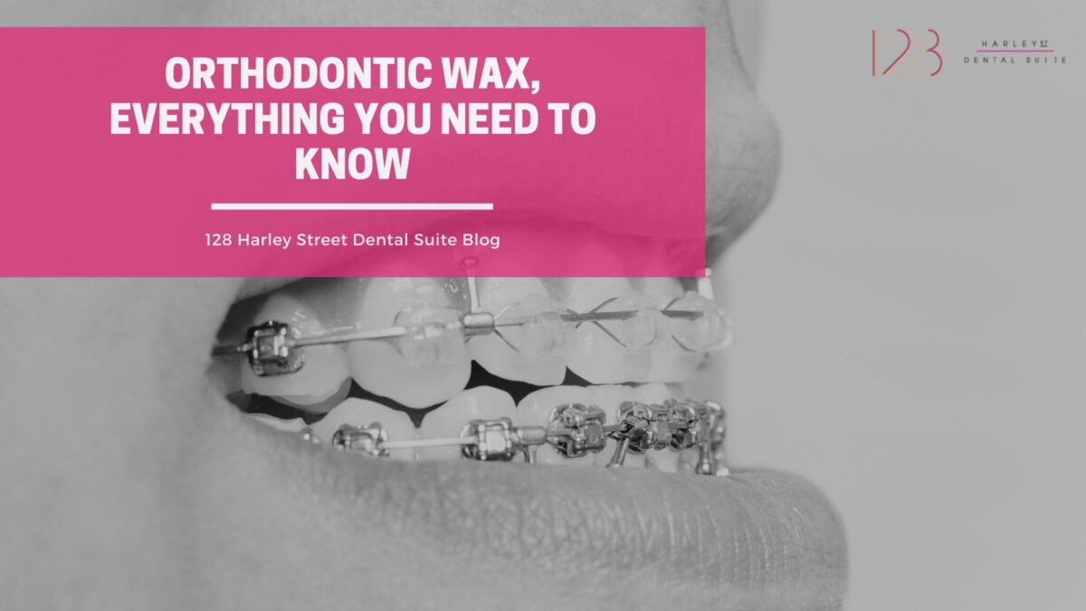 Orthodontic Wax, Everything you Need to Know 128 Harley Street Dental