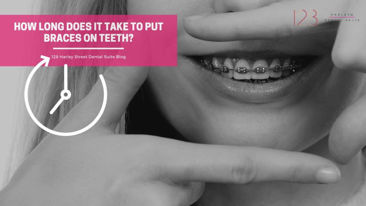 How long does it take to put braces on teeth 128 Harley Street Dental