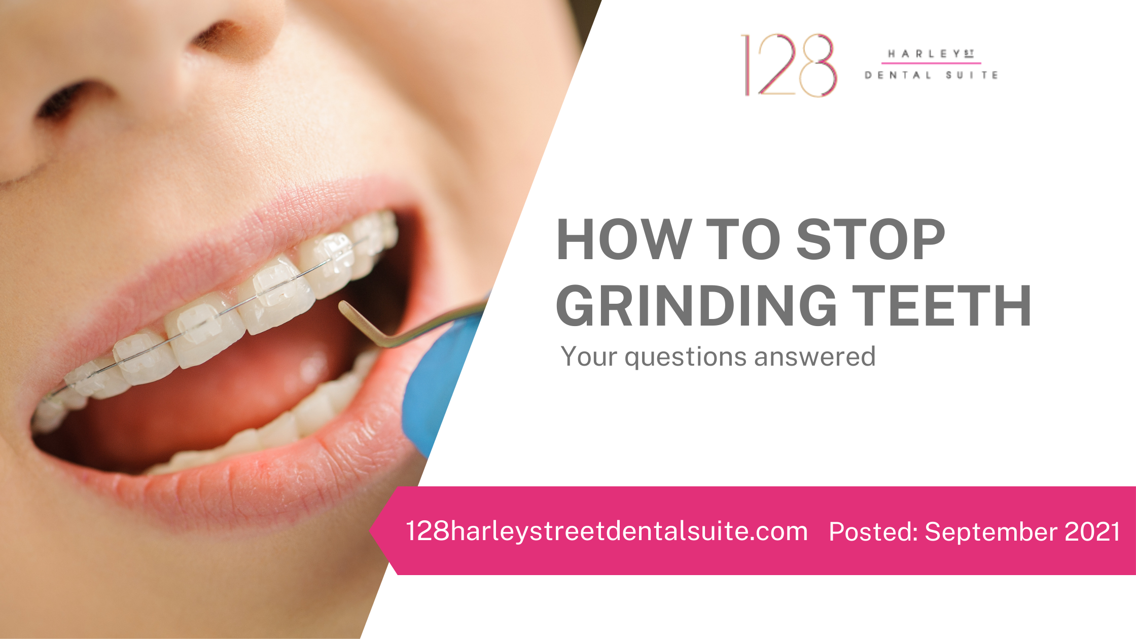 How to stop grinding teeth