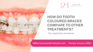 How Do Tooth Coloured Braces Compare To Other Treatments?